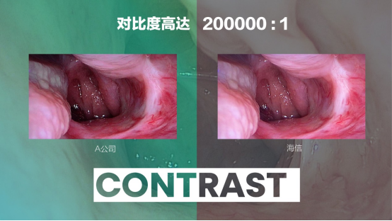 07   海信發布全球首臺55吋Mini-LED醫用內窺顯示器365.png